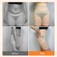 Buikwandcorrectie Hoge Taille Shapewear